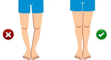 پای پرانتزی