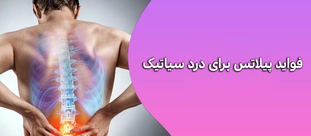 فواید پیلاتس برای درد سیاتیک