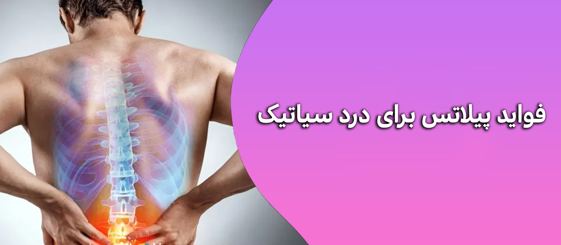 فواید پیلاتس برای درد سیاتیک